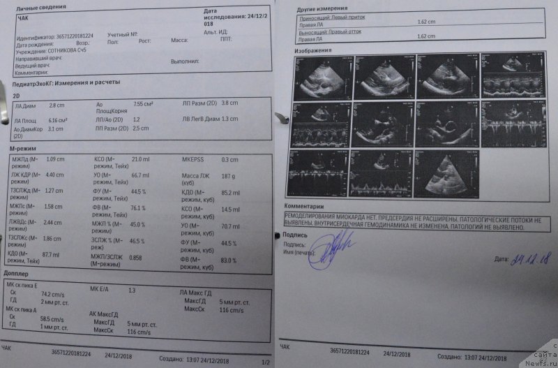 Фото: ньюфаундленд Smigar Agday Virtus (Смигар Агдай Виртус)