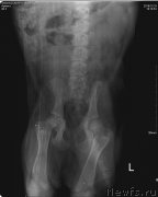 Превью фото № 217192